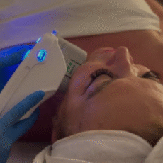 FaceLift Facial completo con Papada