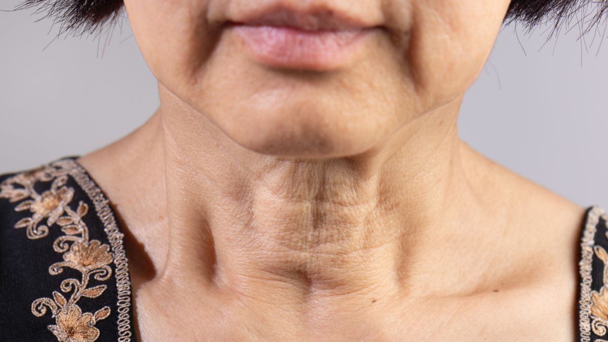 Tratamientos no invasivos para la flacidez facial