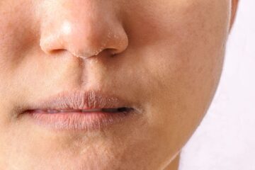 Pure Glow: Hidratación profunda para pieles secas.