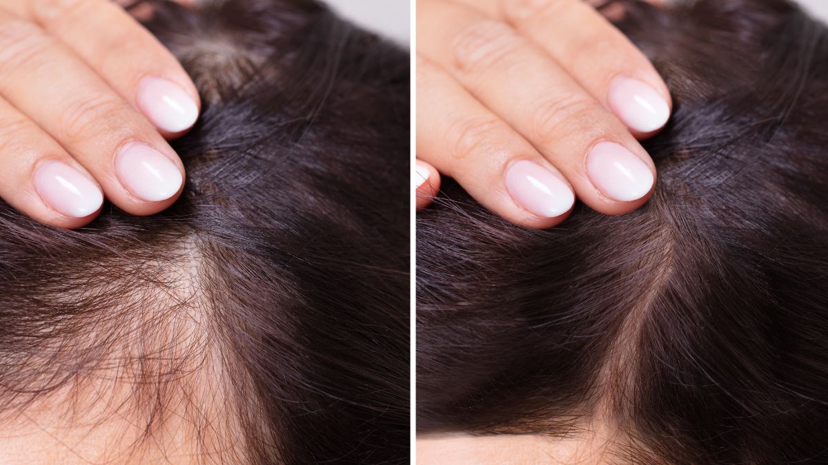 tratamientos capilares soluciones eficaces